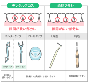 フロス・歯間ブラシ使い分け